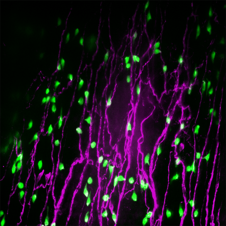 Bright green dots are scattered throughout pink stringlike strands that are vertical in this image. The green dots are neuroendocrine cells from a mouse airway and the pink is part of the nervous system.