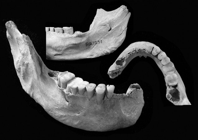 Views of parts of a lower jaw (on a black background) recovered from the partial skeleton of a 40,000-year-old Homo sapiens that was found in a cave in China.